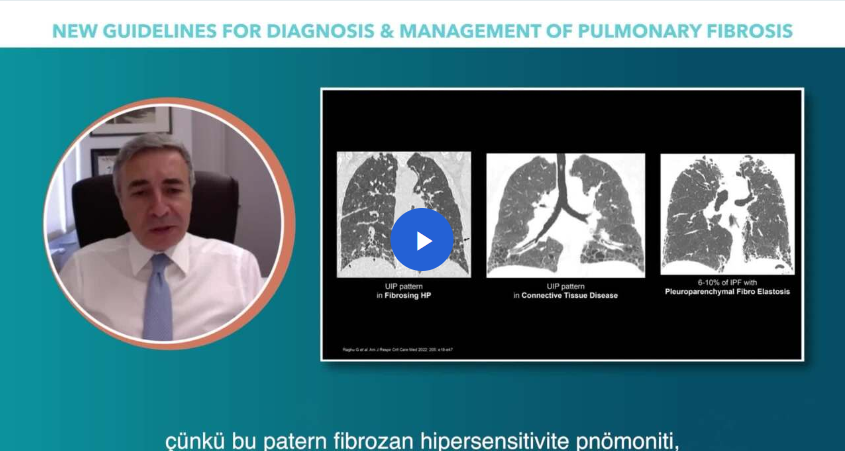 /tr/respiratory/ofev/guideline/dr-luca-richeldi-ipf-tansnda-radyolojik-acdan-guncellemeler