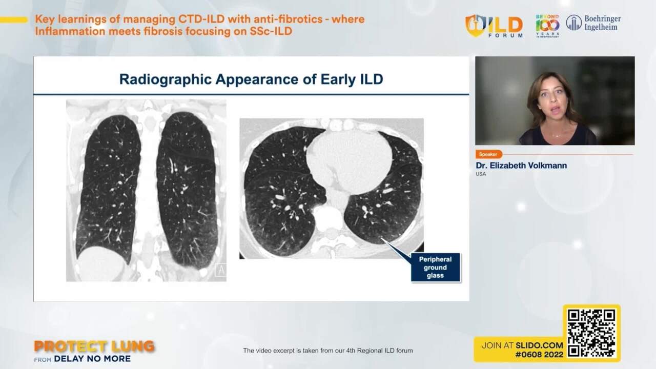 /ph/inflammation/nintedanib/ssc-ild/initiating-treatment-ssc-ild