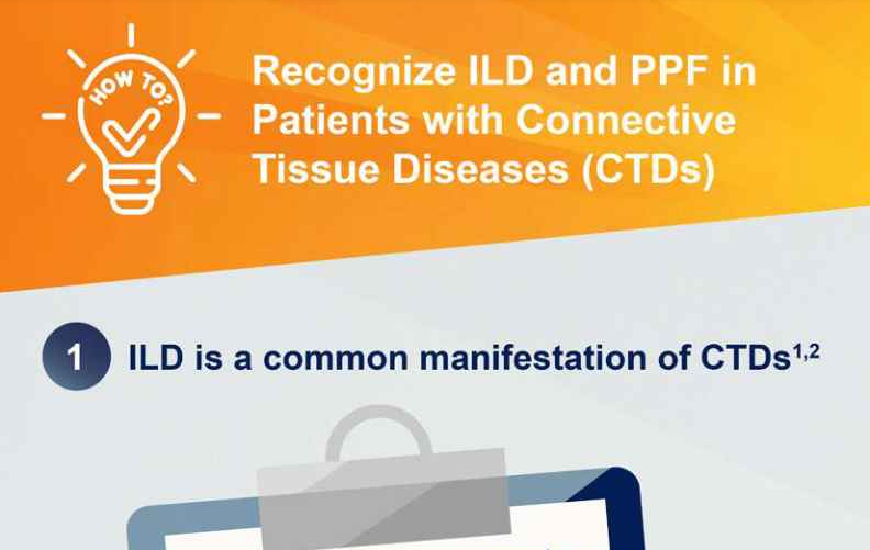 /ph/inflammation/nintedanib/about-pulmonary-fibrosis/how-recognize-ild-ppf-patients-ctd