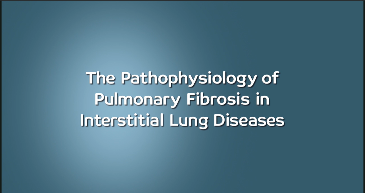 /my/inflammation/nintedanib/about-pulmonary-fibrosis/discover-common-link-interstitial-lung-diseases