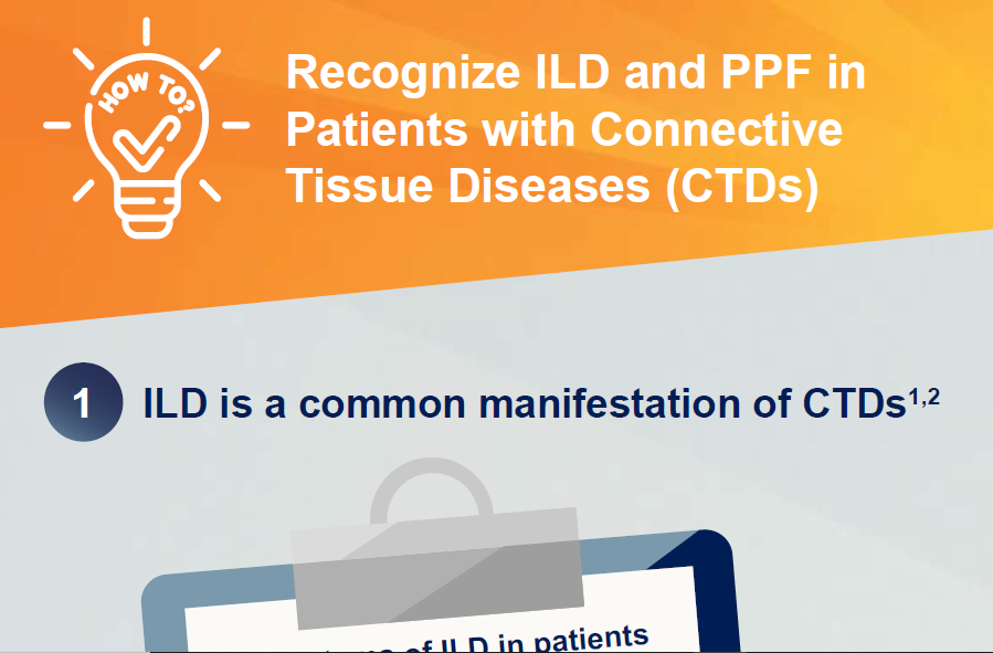 /my/inflammation/nintedanib/about-pulmonary-fibrosis/how-recognize-ild-ppf-patients-ctd