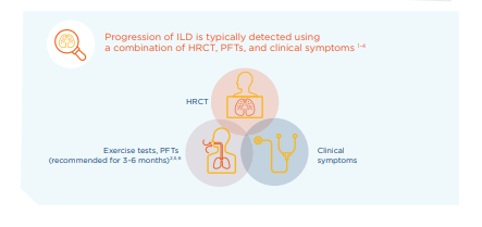 /sg/inflammation/nintedanib/efficacy/key-managing-progression-ssc-ild-patients