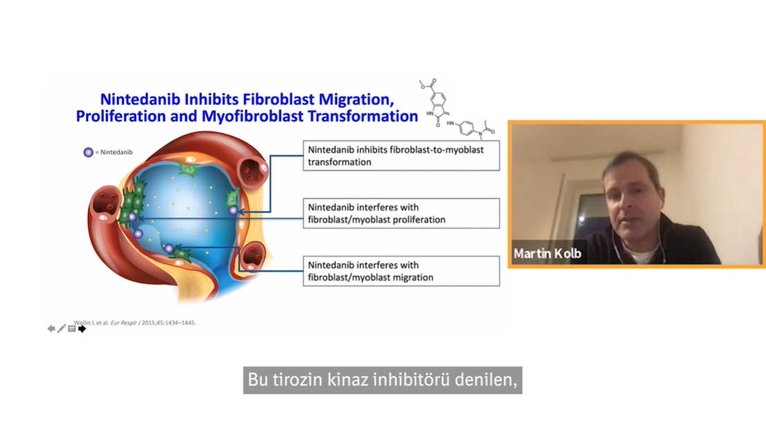 /tr/solunum/ofev/dr-martin-Kolb-ipf/dr-kolb-martin-nintedanib-etki-mekanizmasi