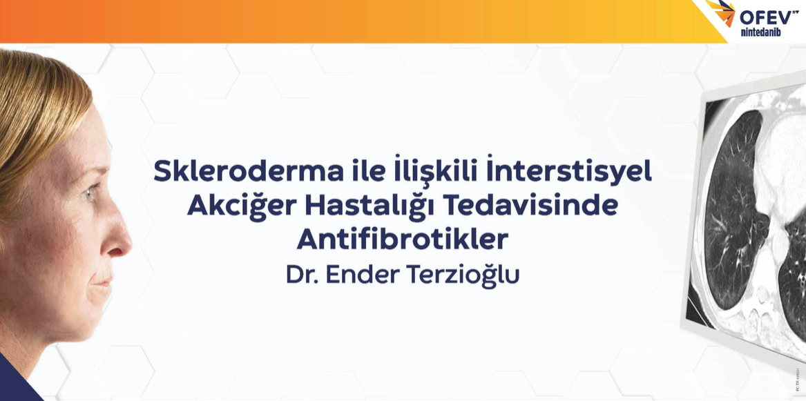 Dr. Ender Terzioğlu - Skleroderma İle İlişkili İnterstisyel Akciğer Hastalığı Tedavisinde Antifibrotikler