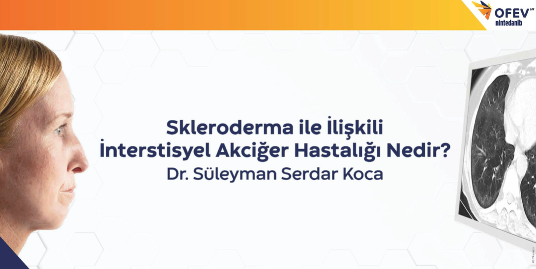 Dr. Süleyman Serdar Koca - Skleroderma İle İlişkili İnterstisyel Akciğer Hastalığı Nedir?