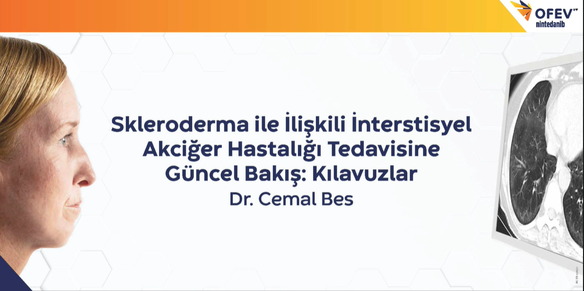 Dr. Cemal Bes - Skleroderma İle İlişkili İnterstisyel Akciğer Hastalığı Tedavisine Güncel Bakış: Kılavuzlar