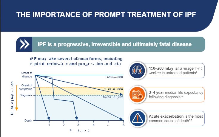 /sg/inflammation/nintedanib/about-pulmonary-fibrosis/importance-prompt-treatment-ipf