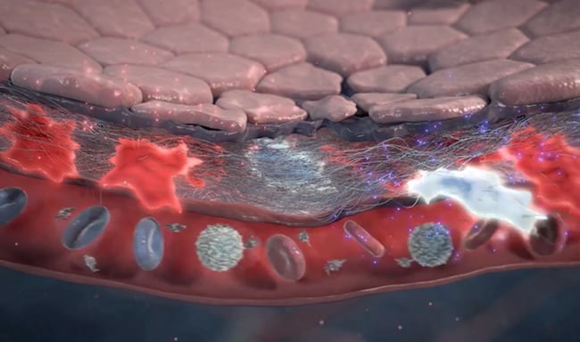 Mechanism of Action