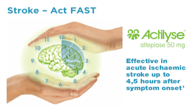 How should you perform the F.A.S.T. Test?