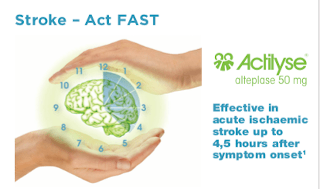 Post Call - Benefits of Earlier Treatment with Actilyse for Stroke Patient