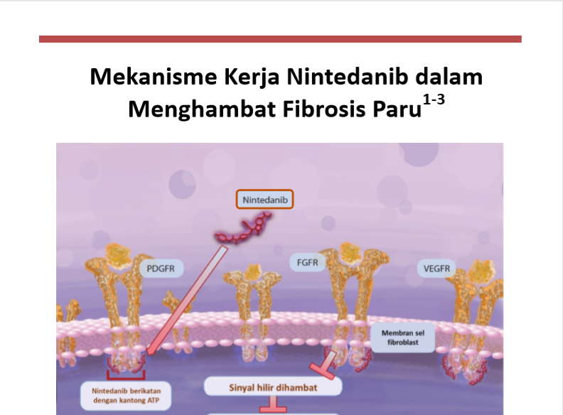 /id/fibrosis-paru/ofev/mekanisme-kerja/mekanisme-kerja-nintedanib