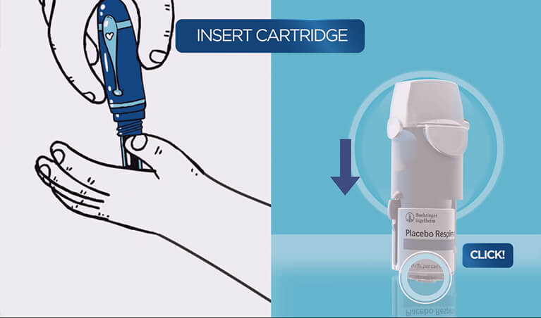 Respimat® Device Assembly - Preparation for First Use